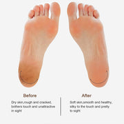 Electric Foot File Rechargeable Callus Hard Skin Remover Feet Pedicure 2 Speeds — 5